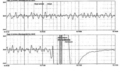 sudden_cardiac_death_img_01