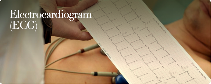 Electrocardiogram (ECG)