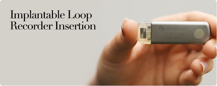 Implantable Loop Recorder Insertion