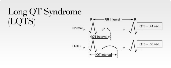 Long QT Syndrome (LQTS)