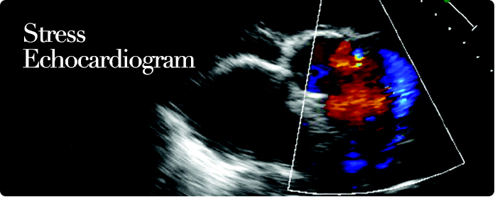 Stress Echocardiogram